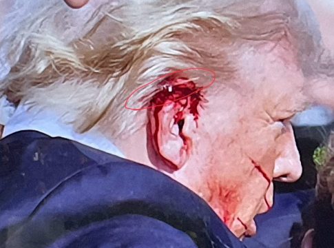 Donald Trump Survives Assassination Attempt