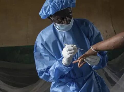 Ghana Records First Case Of Mpox